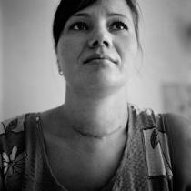 Porträt von Galina Miroshnichenko - Dokumentation der Opfer von Tschernobyl (sie hat Schilddrüsenkrebs)