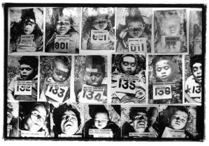 Unidentifizierte Kinderopfer der Bhopal Katastrophe