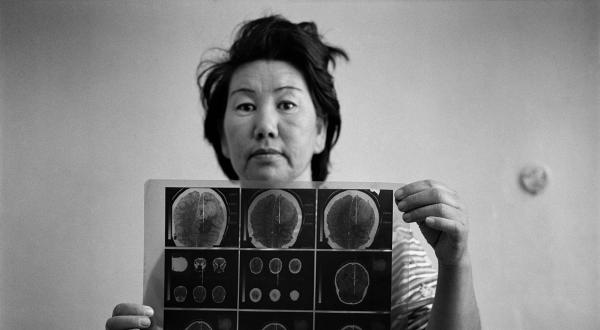 April 1999: Dsunusowa Gulsum leidet an einem Gehirntumor. Sie lebt im Atombombentestgebiet.