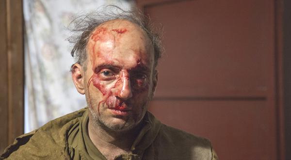 Michael Kreindlin von Greenpeace Russland, verletzt und mit Blut im Gesicht nach einem Angriff